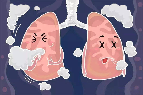 慢阻肺病,慢阻肺